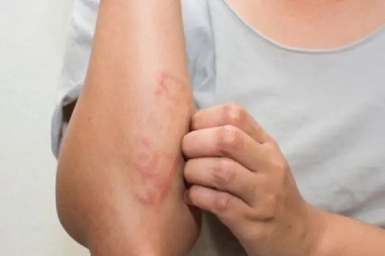 Dermatologové prozradili: Proč nikdy nepoužívat kokosový olej na obličej