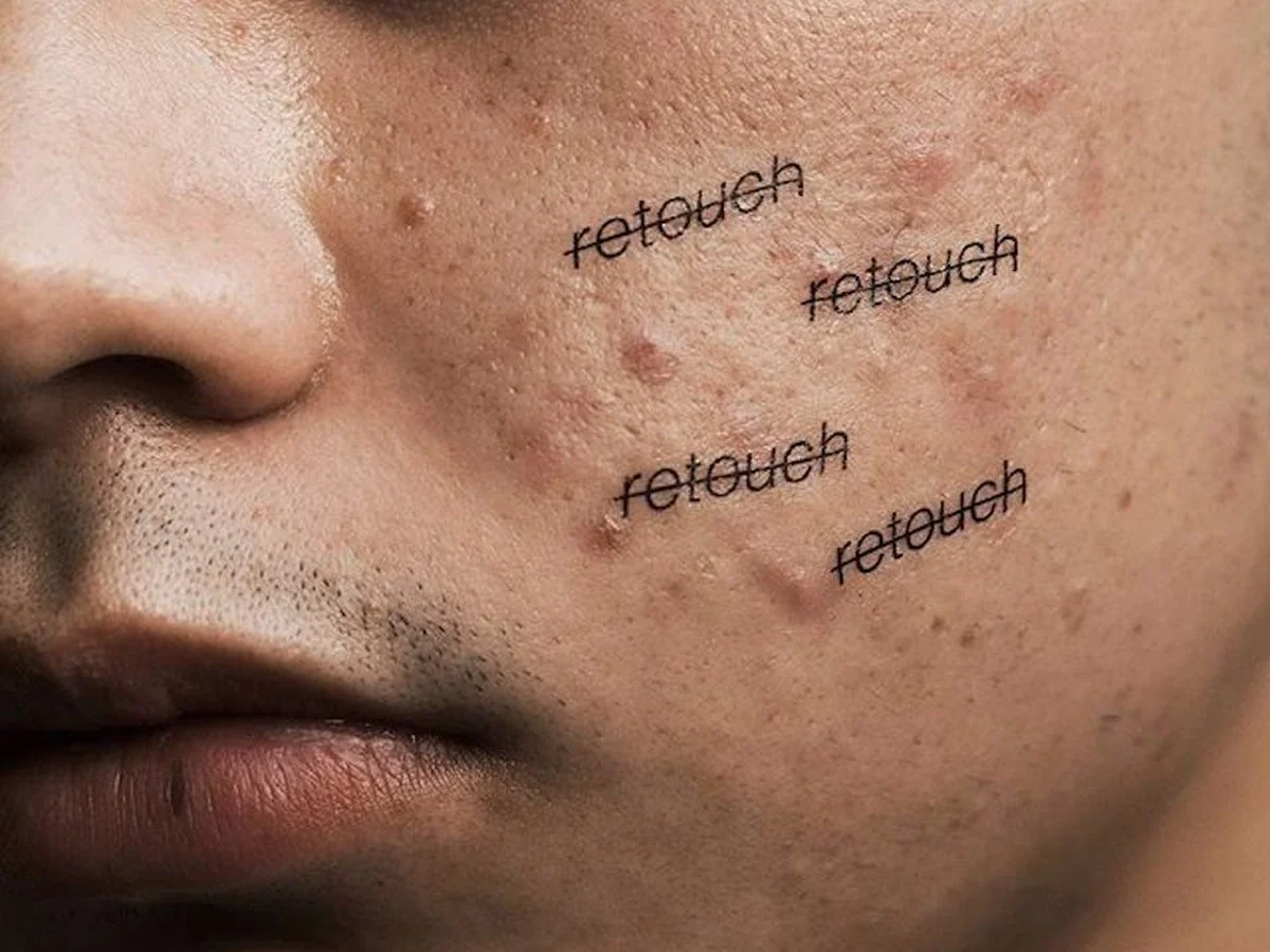 Dermatologové prozradili: Proč nikdy nepoužívat kokosový olej na obličej - image 1