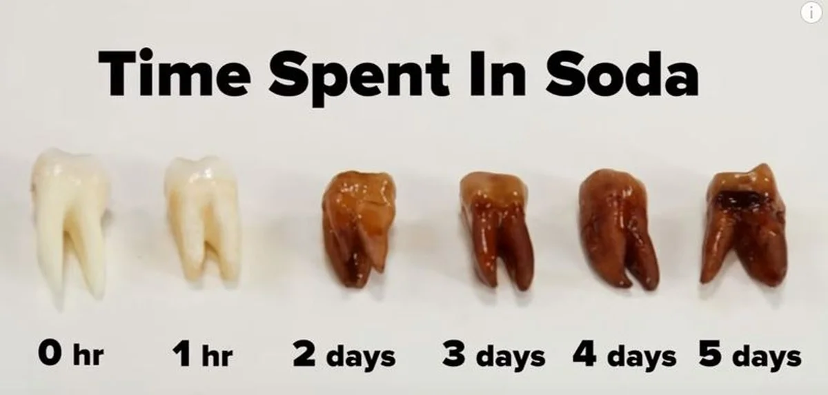 Zubaři prozrazují: Tento běžný nápoj ničí zubní sklovinu více než cukr - image 1
