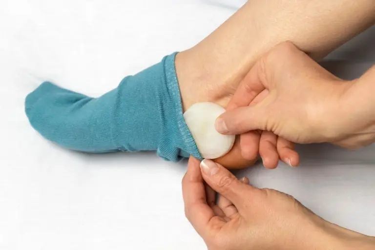 Cibule v ponožkách? Starodávný domácí lék, který skutečně funguje