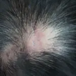 Kadeřníci varují: Tento běžný šampon ničí vlasové folikuly během měsíců.