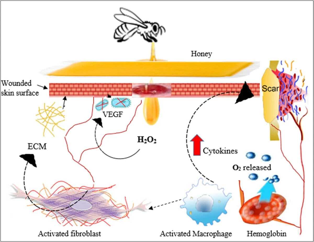 Lžička medu na rány? Vědecky ověřený trik našich předků
